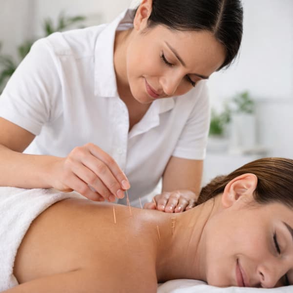 Acupuncture